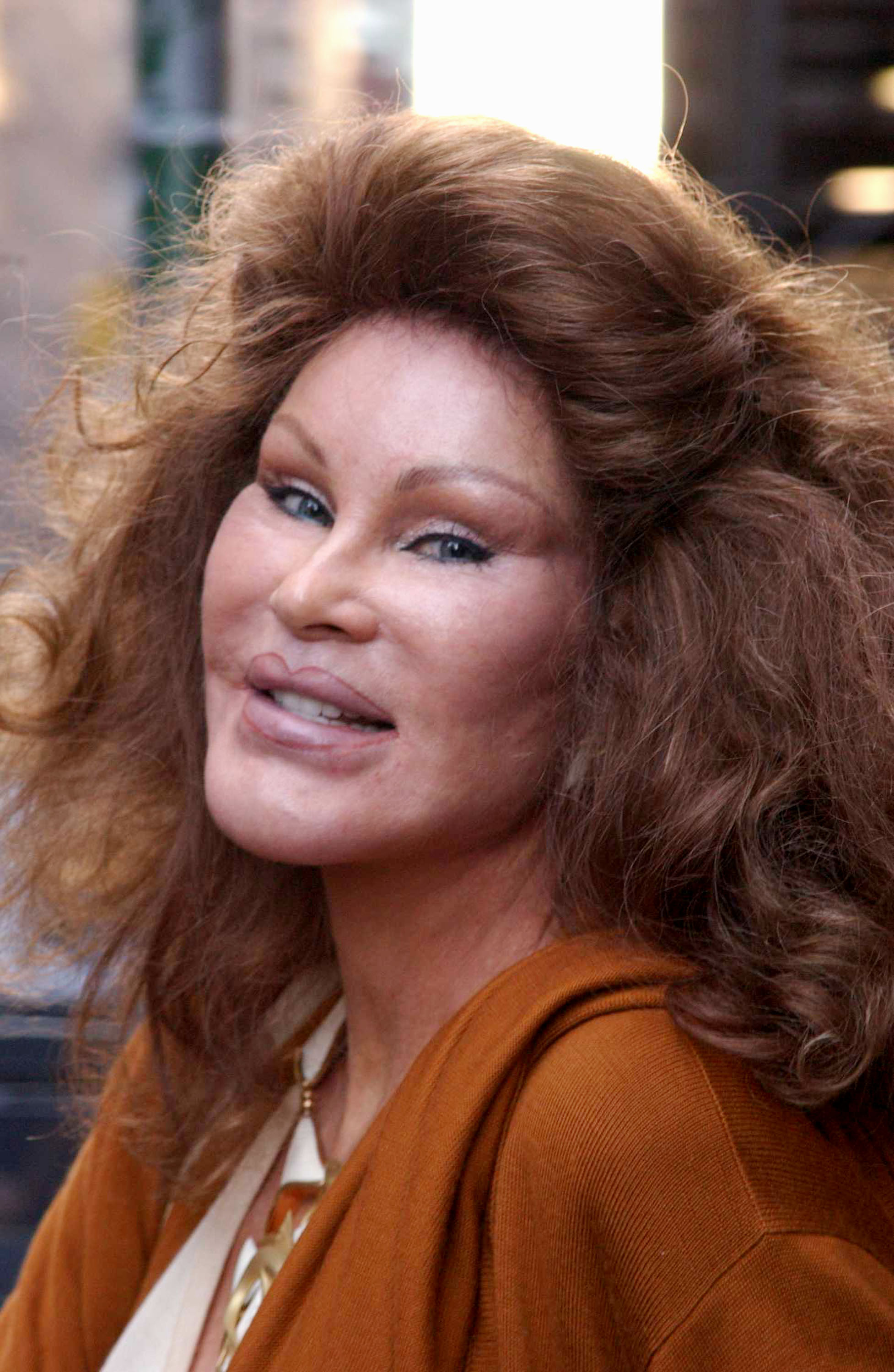 Jocelyne Wildenstein presented a smooth skin texture, eyes with prominent dark liner set beneath dramatically lifted outer brows, and a fixed awkward smile, as she prepared to enter her Rolls Royce after lunching and shopping at Barney's on November 17, 2001, in New York City, New York.